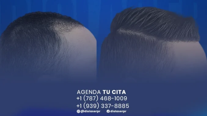 DIOLASERresultados