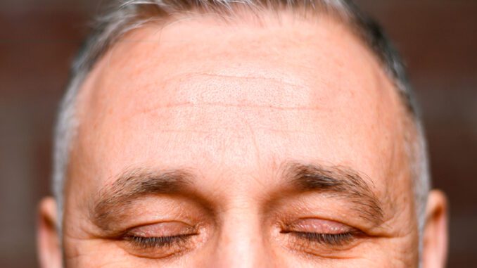 perdida de cejas perdida de cejas