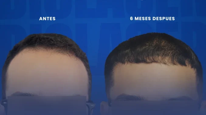 2decadasderesultados