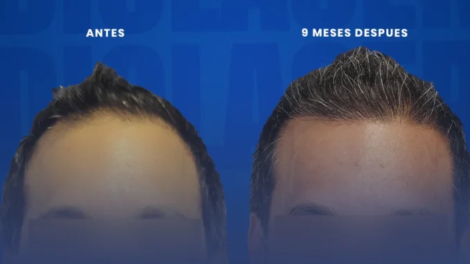 resultadosdiolaser