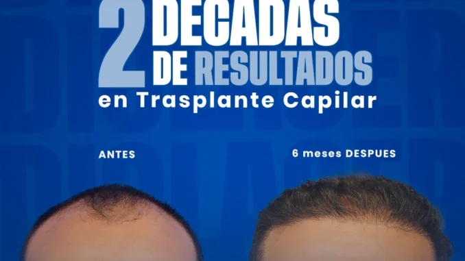 resultadosextosos