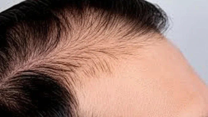 mesoterapiaendiolaser