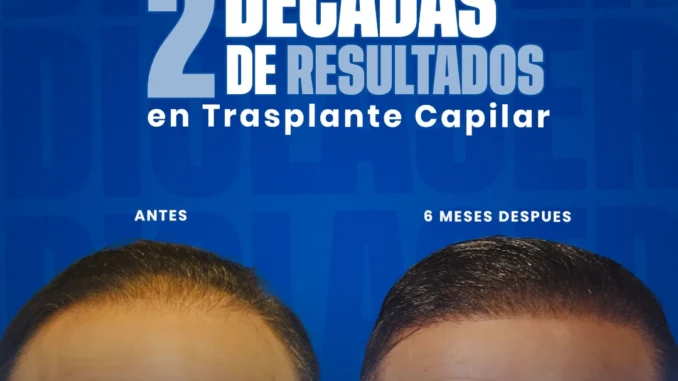 resultadodiolaser