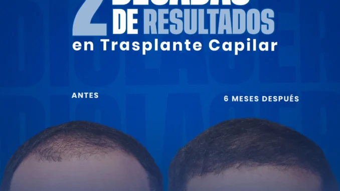 2decadasderesultadosendiolaser