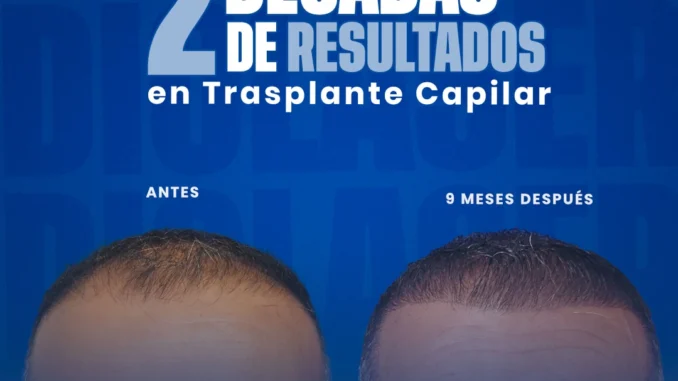 9mesesdespuesdelinjerto