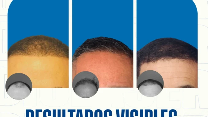 resultados visibles