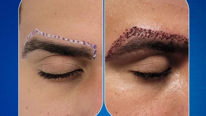 cejas