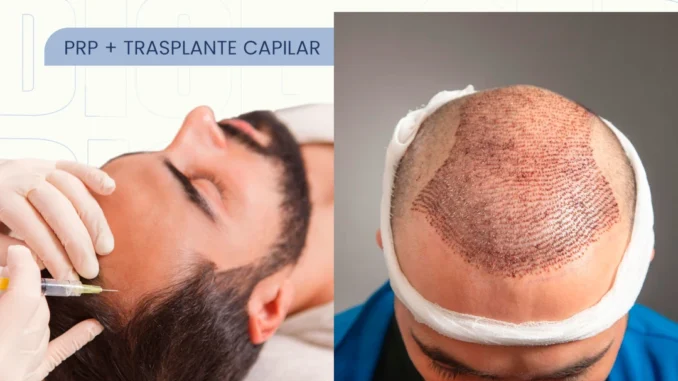 tratamientosdespuesdeltrasplante
