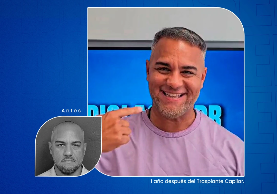 Recupera tu Sonrisa en Diolaser.